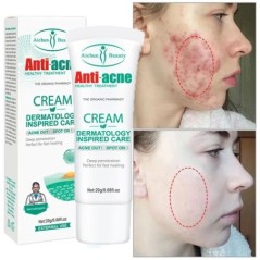 Arbore de ceai Cremă pentru tratarea acneei Reducerea porilor Controlul uleiului Reparare Albire Coș Curățare profundă Cremă hid